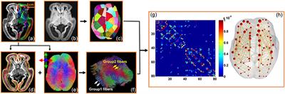 Human Fetal Brain Connectome: Structural Network Development from Middle Fetal Stage to Birth